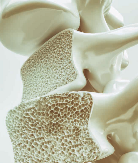 Osteoporose